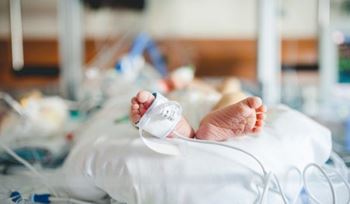 نوزاد ۵ روزه به علت زردی و تشنج در بیمارستان بستری شده است.