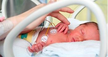 نوزاد دختر زودتر از موعد به دنیا آمده است و نیاز به بستری دارد.