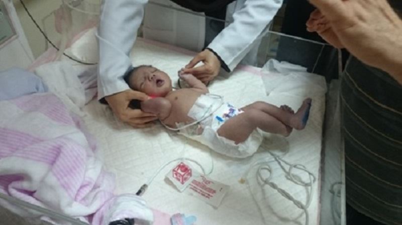 بیمار نوزاد&nbsp;یک ماهه است که به دلیل پره ترم بستری شده است.
