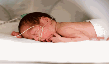 نوزاد دختر حس&zwnj;مهری به دلیل افت قند در بدو تولد بستری شده است.