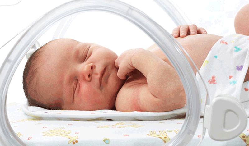 نوزاد دختر تازه متولد به دلیل نارسایی ریوی بستری شده است.