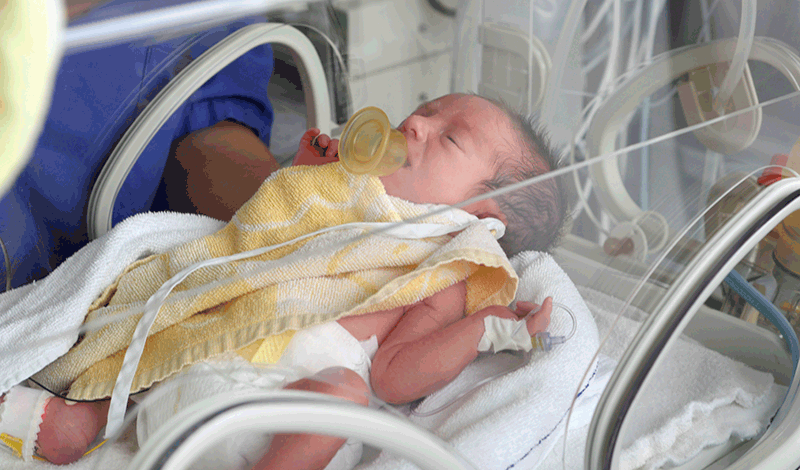 نوزاد تازه&zwnj;متولد به دلیل زردی و مشکل تنفسی بستری شده است.