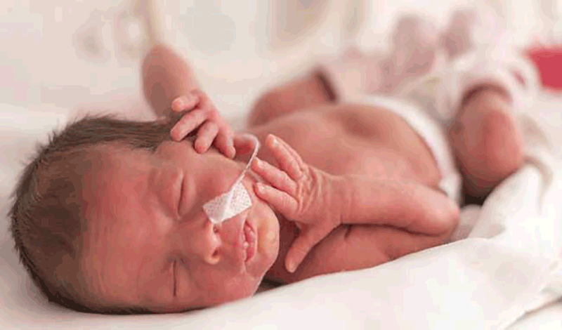 نوزاد تازه متولد به دلیل دیسترس تنفسی بستری شده است.