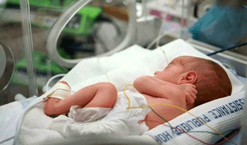 نوزاد تازه&zwnj;متولد به دلیل بیماری قلبی بستری شده است.