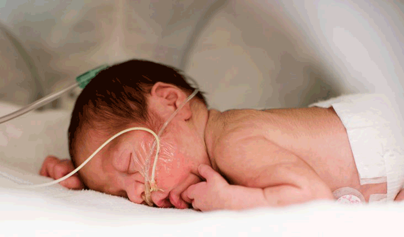 محمدامین تازه&zwnj;متولد به دلیل تشنج بستری شده است.