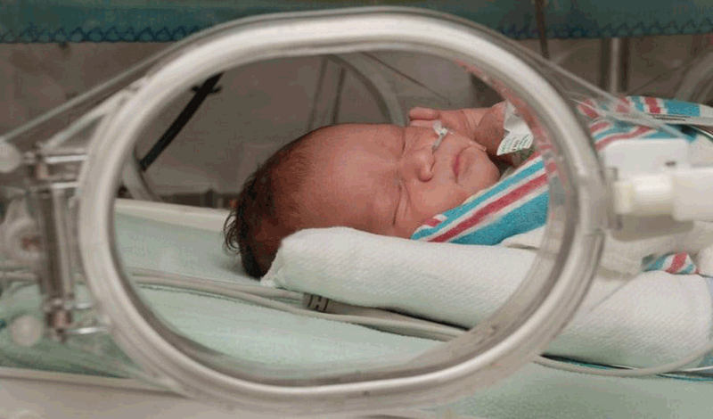 نوزاد تازه متولد به دلیل کلیه پلی کیستیک بستری شده است.