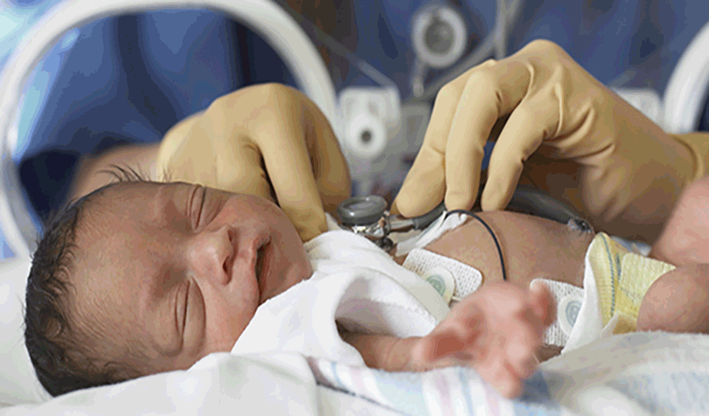 نوزاد تازه&zwnj;متولد به دلیل بیماری RDS بستری شده است.