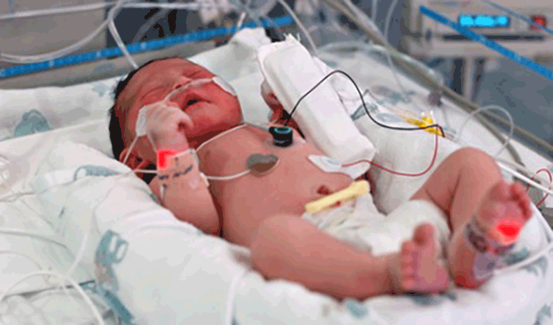 احمدرضا تازه&zwnj;متولد به دلیل نارسایی قلبی ریوی بستری شده است.