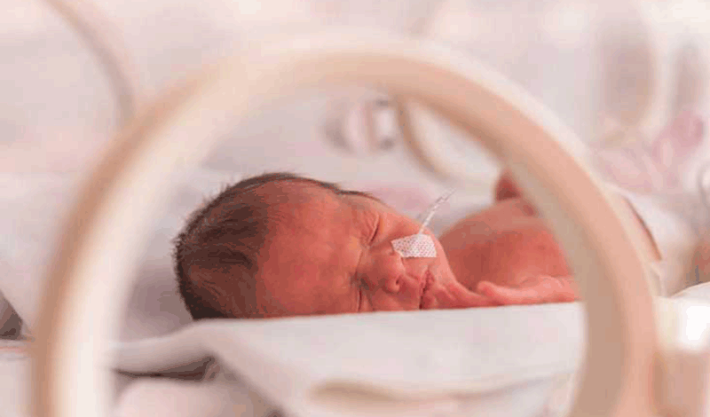 نوزاد&nbsp;تازه&zwnj;متولد به دلیل نارس بودن و دیسترس تنفسی بستری شده است.