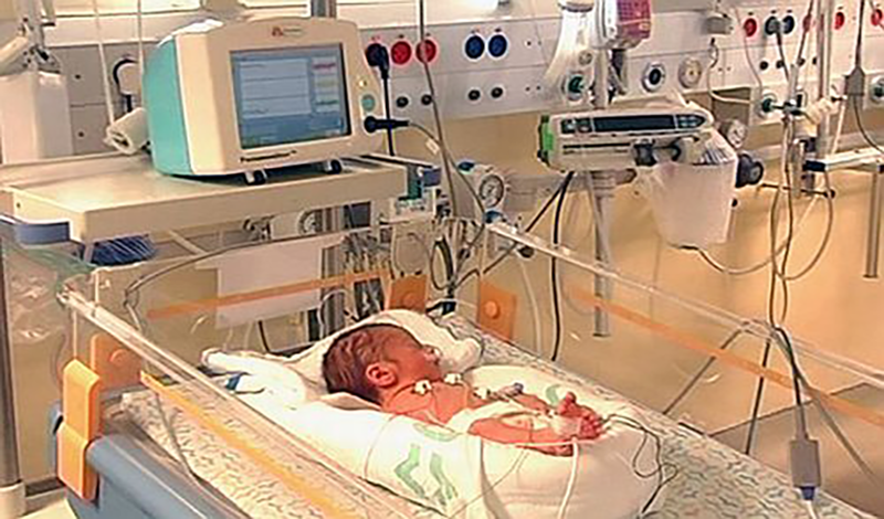 نوزاد تازه متولد به دلیل دیسترس تنفسی بستری شده است.