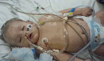 محمدآراد ده&zwnj;ماهه به دلیل دیسترس تنفسی بستری شده است.