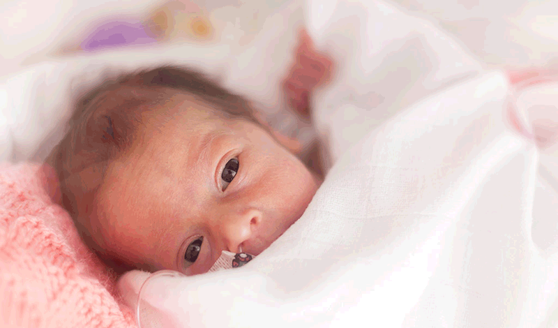 نوزاد تازه&zwnj;متولد&nbsp;به دلیل بیماری پروانه&zwnj;ای بستری شده است.