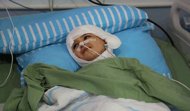محمدرضا شش ساله به دلیل سوختگی بستری شده است.