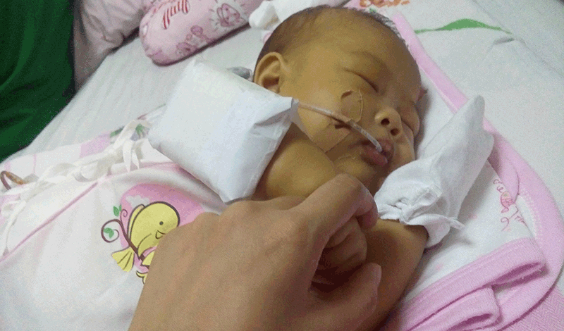نوزاد تازه&zwnj;متولد به دلیل سیانوز بستری شده است.
