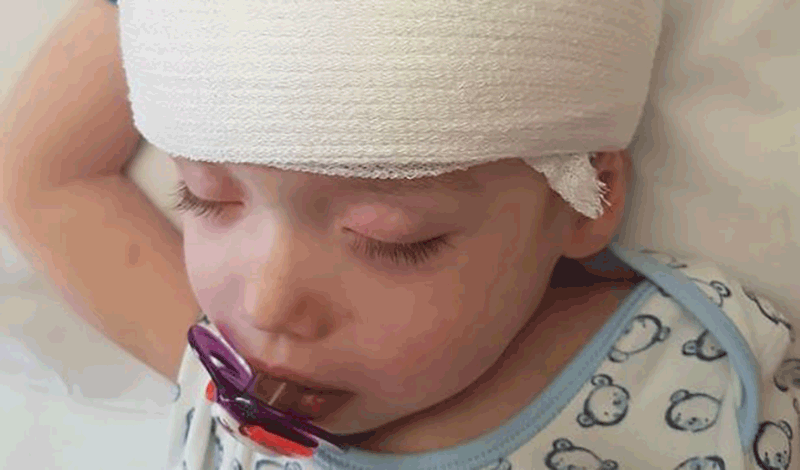 محمدعمر دو ساله به دلیل&nbsp;ضربه به سر&nbsp;بستری شده است.
