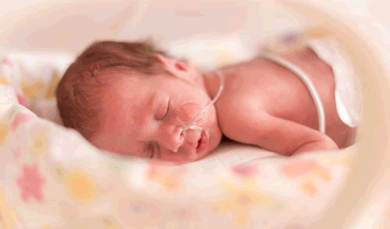 نوزاد&nbsp;تازه&zwnj;متولد به دلیل عفونت ریه بستری شده است.