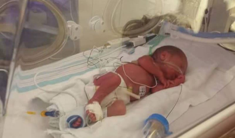 نوزاد تازه متولد به دلیل سیانوز بستری شده است.