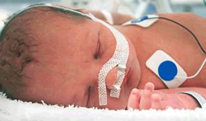 نوزاد تازه متولد به دلیل بیماری تنفسی بستری شده است.&nbsp;