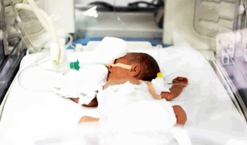 نوزاد تازه متولد&nbsp;به دلیل&nbsp;دیسترس تنفسی بستری شده است.