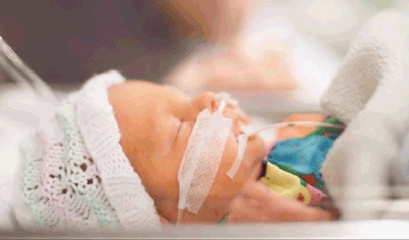 نوزاد تازه&zwnj;متولد به دلیل&nbsp;دیسترس&nbsp;تنفسی بستری شده است.