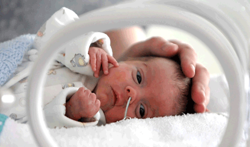 نوزاد&nbsp;تازه متولد&nbsp;به دلیل&nbsp;نارس بودن و مشکل تنفسی بستری شده است.