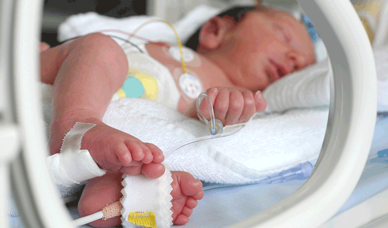 نوزاد تازه&zwnj;متولد به دلیل&nbsp;دیسترس تنفسی&nbsp;بستری شده است.