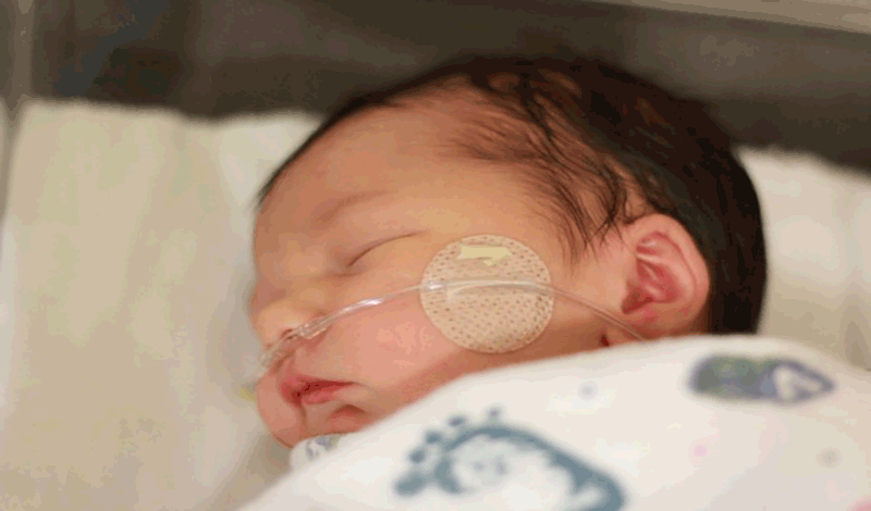 احمدرضا(1)نوزاد&nbsp;تازه&zwnj;متولد&nbsp;به دلیل مشکلات&nbsp;تنفسی بستری شده است.
