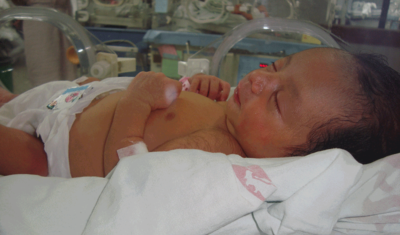 نوزاد تازه&zwnj;متولد به دلیل&nbsp;مننژیت بستری شده است.