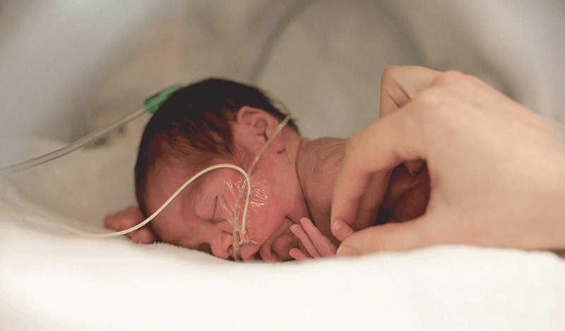 نوزاد تازه&zwnj;متولد به دلیل&nbsp;عفونت ریه بستری شده است.
