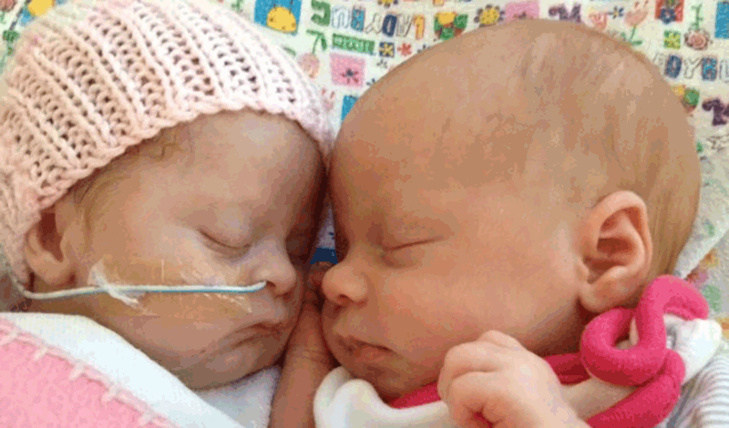 نوزاد تازه&zwnj;متولد قل دوم به دلیل&nbsp;نارس بودن&nbsp;بستری شده است.