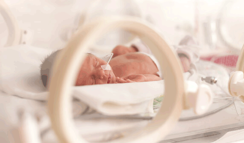 نوزاد تازه&zwnj;متولد به دلیل عفونت ریه بستری شده است.