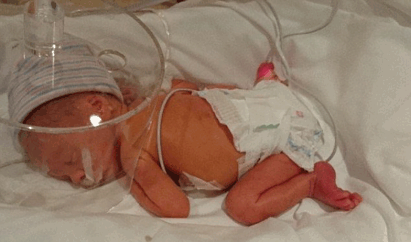 نوزاد تازه&zwnj;متولد&nbsp;به دلیل عفونت ریه بستری شده است.