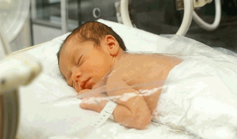 نوزاد تازه&zwnj;متولد به دلیل زردی بستری شده است.
&nbsp;
