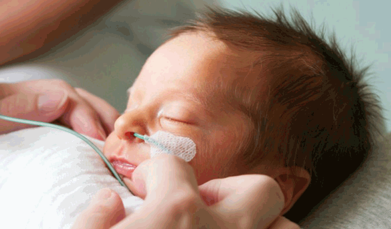نوزاد&nbsp;تازه&zwnj;متولد به دلیل&nbsp;مشکلات تنفسی بستری شده است.