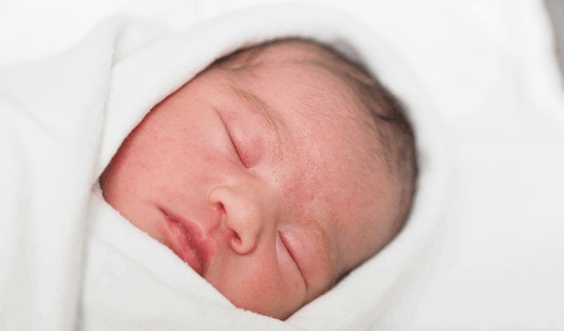 نوزاد تازه&zwnj;متولد به دلیل زردی بستری شده است.