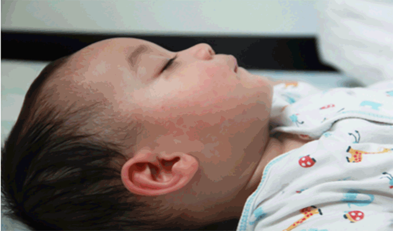 نوزاد تازه&zwnj;متولد به دلیل مسمومیت دارویی بستری شده است.