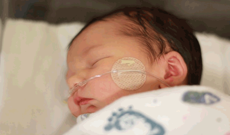

نوزاد&nbsp;تازه&zwnj;متولد&nbsp;به دلیل&nbsp;دیسترس تنفسی بستری شده است.


&nbsp;