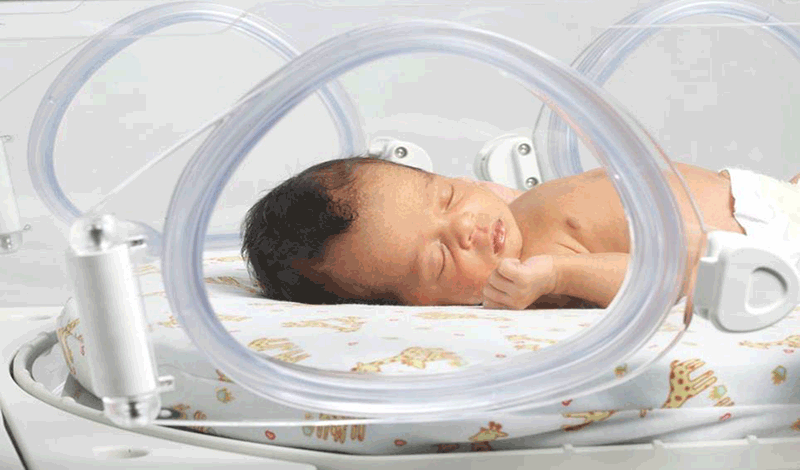 نوزاد&nbsp;تازه&zwnj;متولد به دلیل&nbsp;مشکل تنفسی&nbsp;بستری شده است.