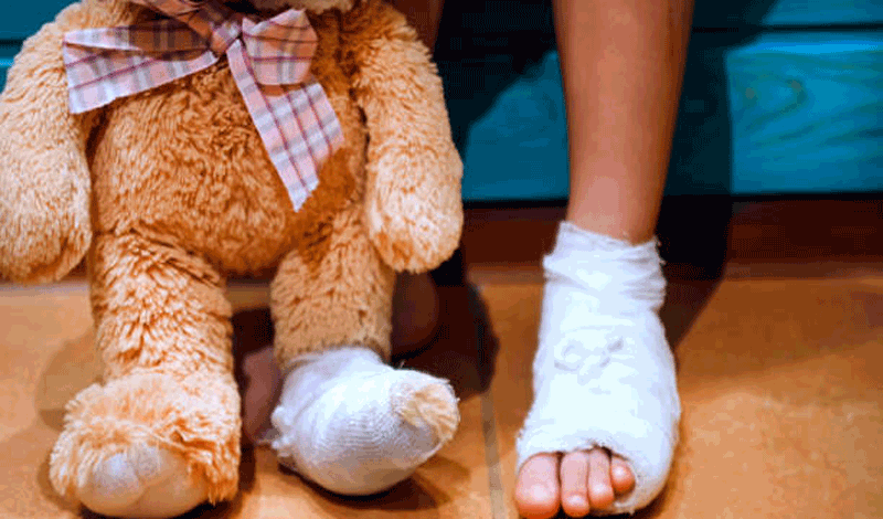 محمد چهارساله به دلیل شکستگی پا بستری شده است.