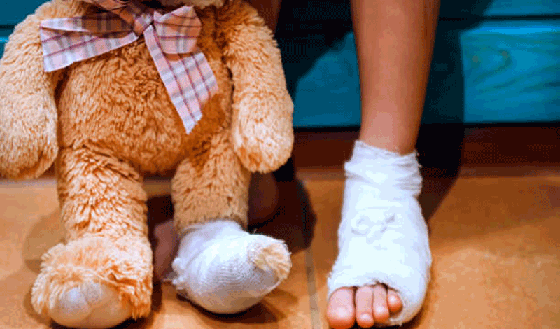 محمدکسری هفت&zwnj;ساله به دلیل شکستگی پا بستری شده است.
