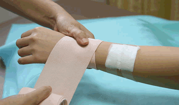 محمدعمر پانزده&zwnj;ساله به دلیل&nbsp;مشکل پوستی بستری شده است.