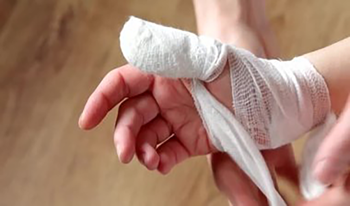 محمدرضا(1)پانزده&zwnj;ساله به دلیل تروما به دست بستری شده است.
